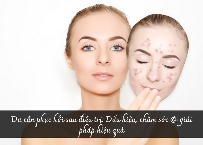 Da cần phục hồi sau điều trị: Dấu hiệu, chăm sóc & giải pháp hiệu quả