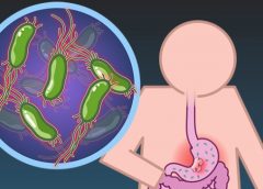 Phân Biệt Vi khuẩn Hp và Hpv Tránh Nhầm Lẫn Tại Hại